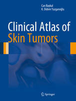 Clinical Atlas Of Skin Tumors 1st Edition Can Baykal K Didem Yazganolu Auth