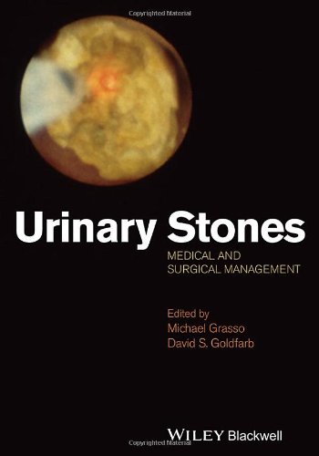 Urinary Stones Medical And Surgical Management 1st Edition Michael Grasso