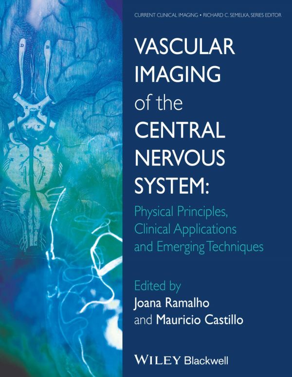Vascular Imaging Of The Central Nervous System Physical Principles Clinical Applications And Emerging Techniques 1st Edition Joana Ramalho