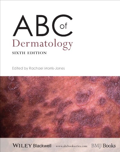 Abc Of Dermatology 6th Edition Rachael Morrisjones