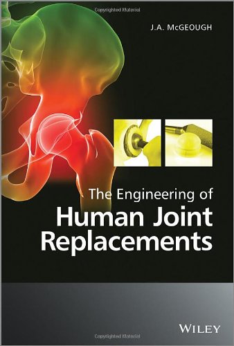 The Engineering Of Human Joint Replacements 1st Edition J A Mcgeough