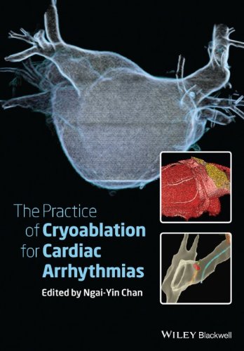 The Practice Of Catheter Cryoablation For Cardiac Arrhythmias 1st Edition Ngaiyin Chan