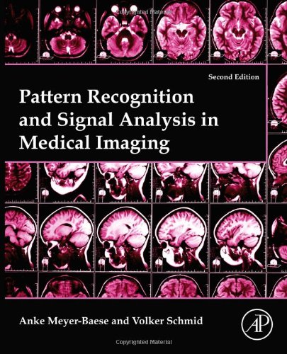 Pattern Recognition And Signal Analysis In Medical Imaging 2nd Edition Anke Meyerbaese And Volker J Schmid Auth