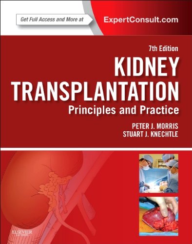 Kidney Transplantationprinciples And Practice 7th Edition Peter Morris And Stuart J Knechtle Auth
