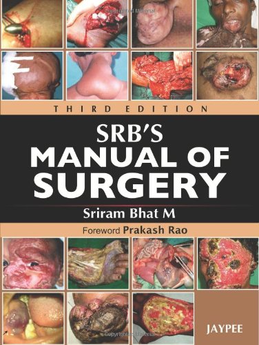 Srbs Manual Of Surgery 3rd Edition Bhat