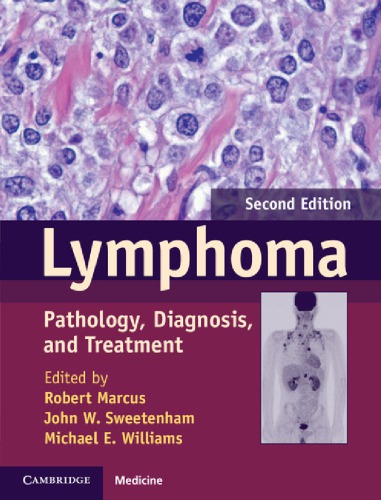 Lymphoma Pathology Diagnosis And Treatment 2ed Marcus R
