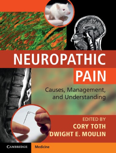 Neuropathic Pain Causes Management And Understanding Toth C