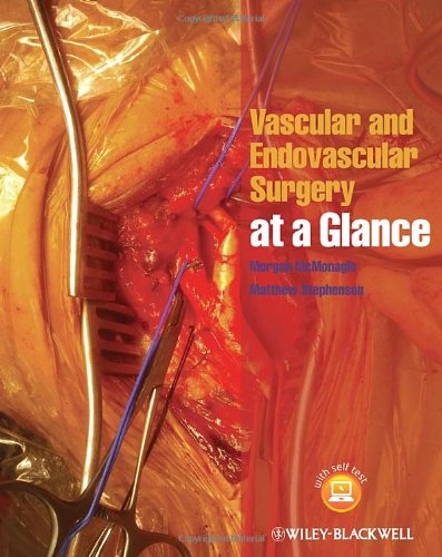 Vascular And Endovascular Surgery At A Glance 1st Edition Morgan Mcmonagle