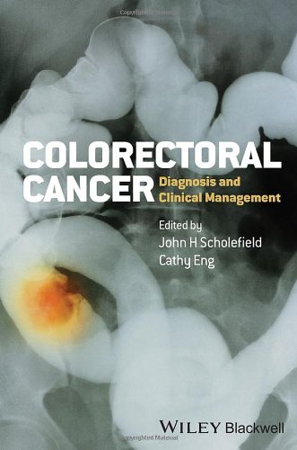 Colorectal Cancer Diagnosis And Clinical Management John Scholefield