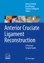 Anterior Cruciate Ligament Reconstruction A Practical Surgical Guide 1st Edition Rainer Siebold