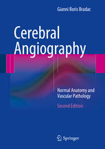 Cerebral Angiography Normal Anatomy And Vascular Pathology 2nd Edition Gianni Boris Bradac Auth
