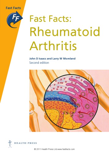 Fast Facts Rheumatoid Arthritis John D Isaacs Larry W Moreland