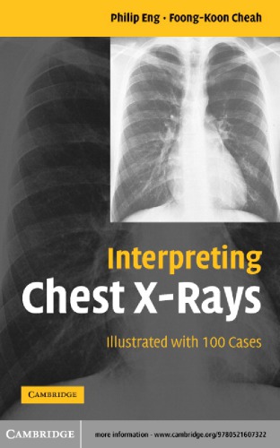 Interpreting Chest Xrays Illustrated With 100 Cases Philip Eng Foongkoon Cheah