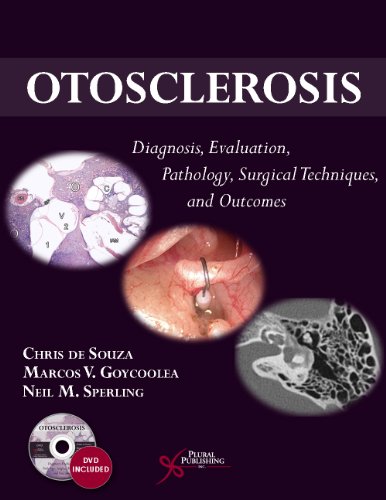 Otosclerosis Diagnosis Evaluation Pathology Surgical Techniques And Outcomes 1st Edition Chris De Souza