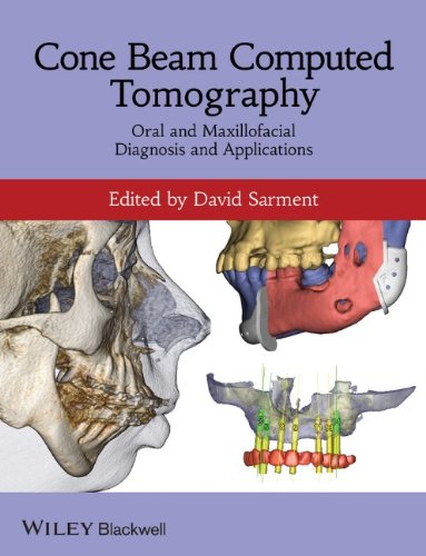 Cone Beam Computed Tomography Oral And Maxillofacial Diagnosis And Applications 1st Edition David Sarment