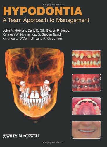 Hypodontia 1st Edition John A Hobkirk Daljit S Gill Steven P Jones