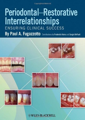 Periodontalrestorative Interrelationships 1st Edition Paul A Fugazzottoauth