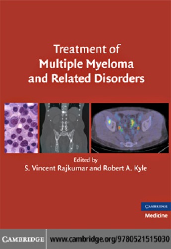 Treatment Of Multiple Myeloma And Related Disorders S Vincent Rajkumar Robert A Kyle