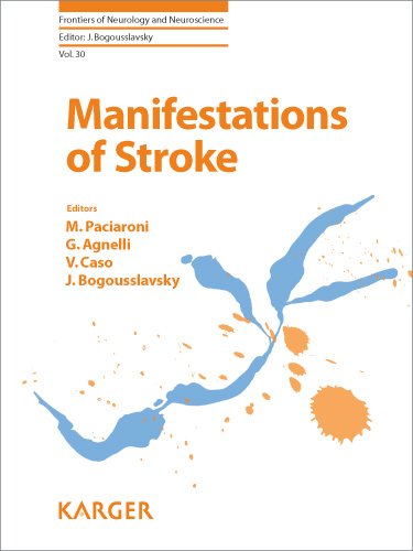 Manifestations Of Stroke 1st Edition M Paciaroni G Agnelli