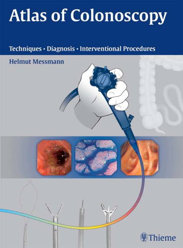 Atlas Of Colonoscopy Examination Techniques And Diagnosis Helmut Messman