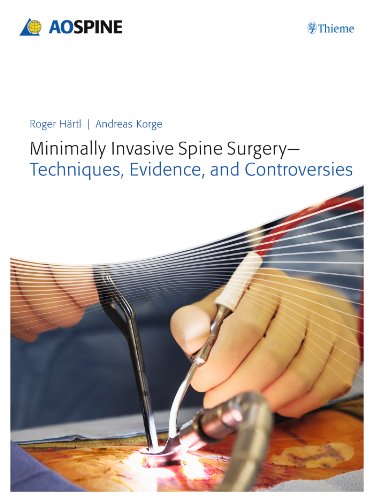 Minimally Invasive Spine Surgery Techniques Evidence And Controversies 1st Edition Roger Haertl