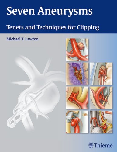 Seven Aneurysms Tenets And Techniques For Clipping 1st Edition Michael T Lawton