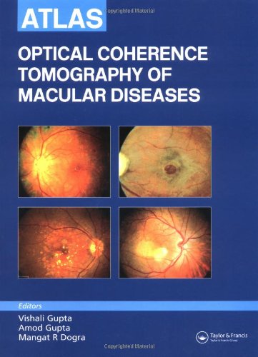 Atlas Of Optical Coherence Tomography Of Macular Diseases 1st Edition Vishali Gupta