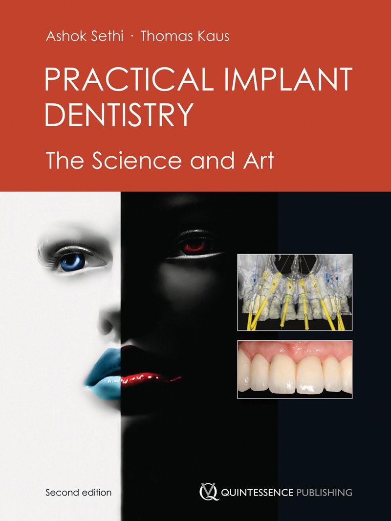Practical Implant Dentistry The Science And Art 2nd Edition Ashok Sethi
