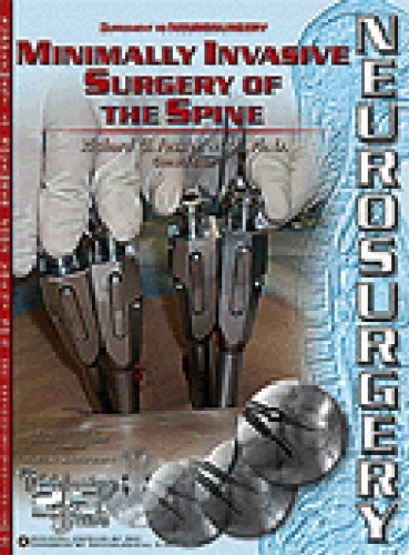 Minimally Invasive Surgery Of The Spine Richard G Fessler Guest Editor