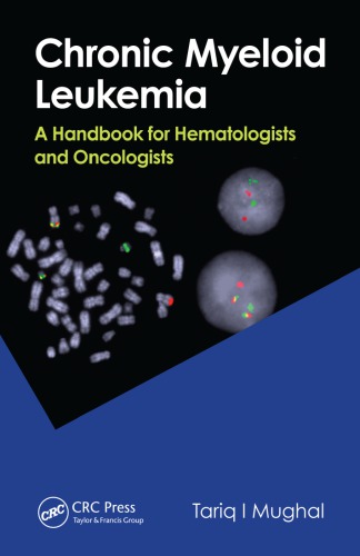 Chronic Myeloid Leukemia A Handbook For Hematologists And Oncologists Tariq I Mughal
