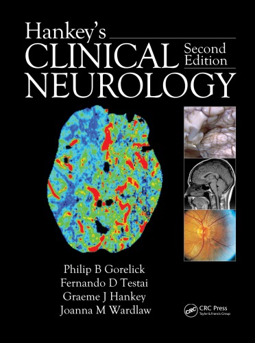 Hankeys Clinical Neurology Second Edition 2nd Edition Giovanni Meola Affiliation Dipartimento Di Neurologia