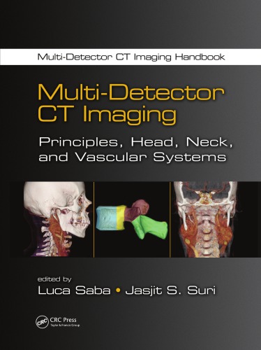 Multidetector Ct Imaging Principles Head Neck And Vascular Systems Luca Saba Jasjit S Suri