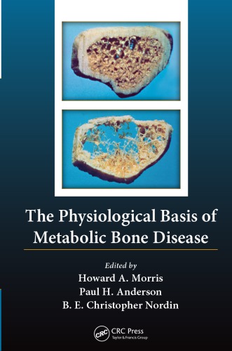 The Physiological Basis Of Metabolic Bone Disease Howard Rasmussen Philippe Bordier