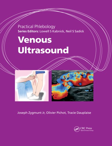 Practical Phlebology Venous Ultrasound Joseph Zygmunt