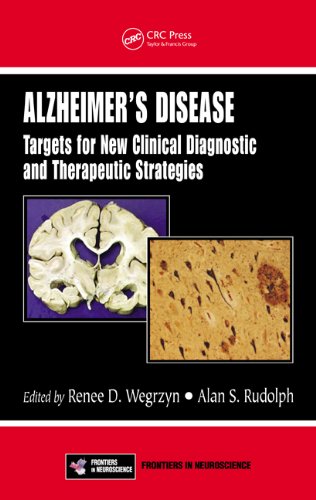 Alzheimers Disease Targets For New Clinical Diagnostic And Therapeutic Strategies 1st Edition Renee D Wegrzyn