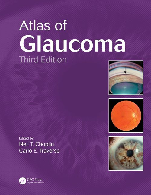 Atlas Of Glaucoma Third Edition 3rd Edition Neil T Choplin