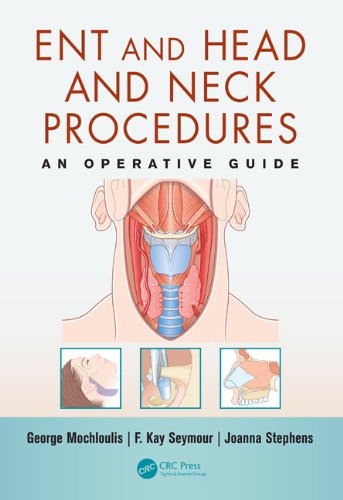 Ent And Head And Neck Procedures An Operative Guide 1st Edition George Mochloulis