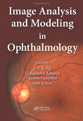Image Analysis And Modeling In Ophthalmology 1st Edition Eddie Y K Ng