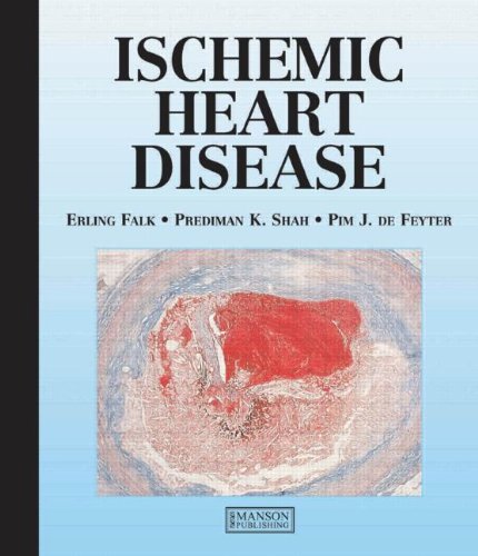 Ischemic Heart Disease 1st Edition Erling Falk Prediman Shah