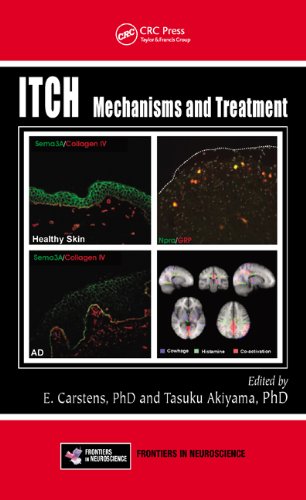 Itch Mechanisms And Treatment 1st Edition E Carstens Tasuku Akiyama