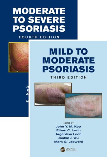 Mild To Moderate And Moderate To Severe Psoriasis Set 3 Pck John Y M Koo