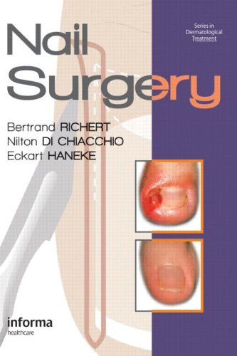 Nail Surgery 1st Edition Bertrand Richert Nilton Di Chiacchio