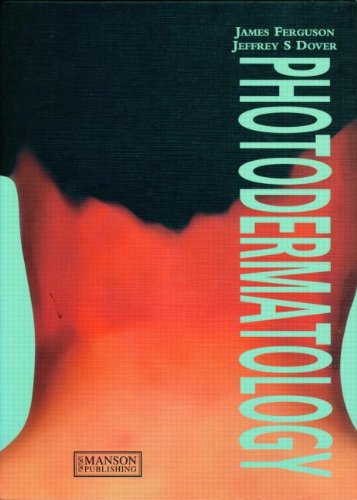 Photodermatology 1st Ferguson