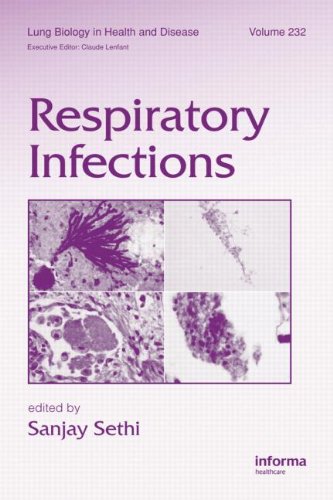 Respiratory Infections 1st Edition Sanjay Sethi