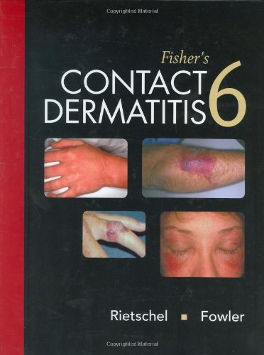 Fishers Contact Dermatitis 6e 6th Edition Robert L Rietschel