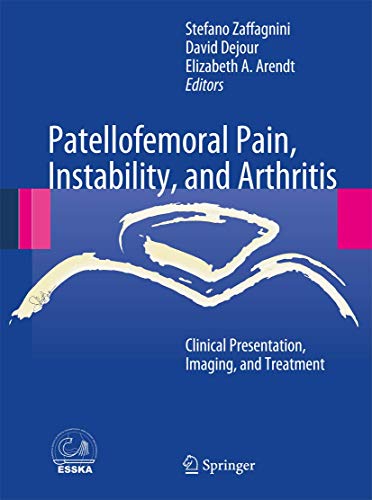 Patellofemoral Pain Instability And Arthritis Stefano Zaffagnini