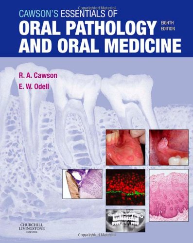 Cawsons Essentials Of Oral Pathology And Oral Medicine 8e 8th Edition Roderick A Cawson Md Fdsrcs Fdsrcpsglas Frcpath Faaomp