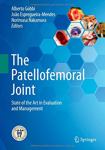The Patellofemoral Joint State Of The Art In Evaluation And Management 2014th Edition Alberto Gobbi