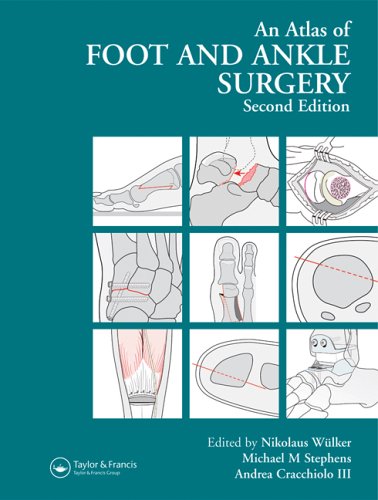 Atlas Foot And Ankle Surgery Second Edition 2nd Edition Nikolaus Wlker
