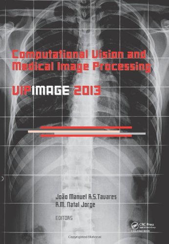 Computational Vision And Medical Image Processing Iv Vipimage 2013 Joao Manuel Rs Tavares